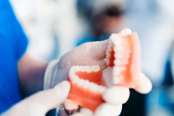 Partial Dentures